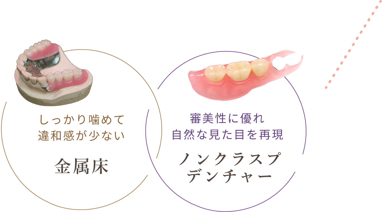 しっかり噛めて違和感が少ない金属床　と　審美性に優れ自然な見た目を再現できるノンクラスプデンチャー