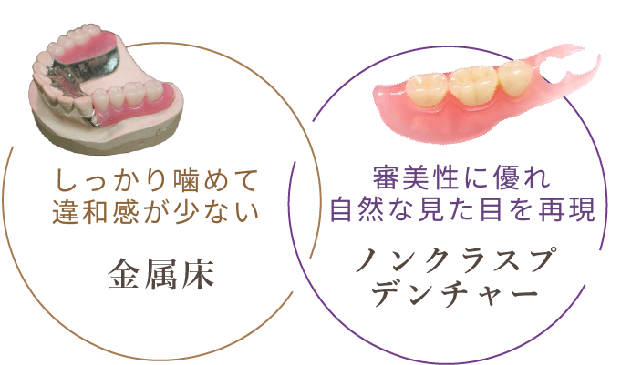 しっかり噛めて違和感が少ない金属床　と　審美性に優れ自然な見た目を再現できるノンクラスプデンチャー